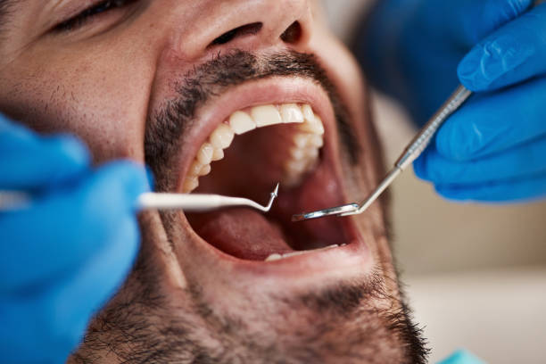 Best Emergency Dentist for Knocked-Out Tooth in Leon Valley, TX